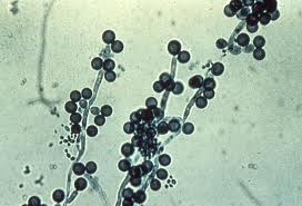 Candida albicans
